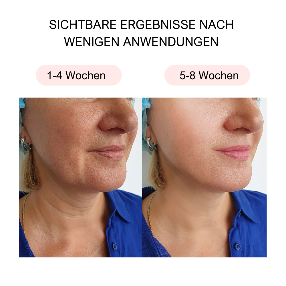 Collagen Wrapping Mask