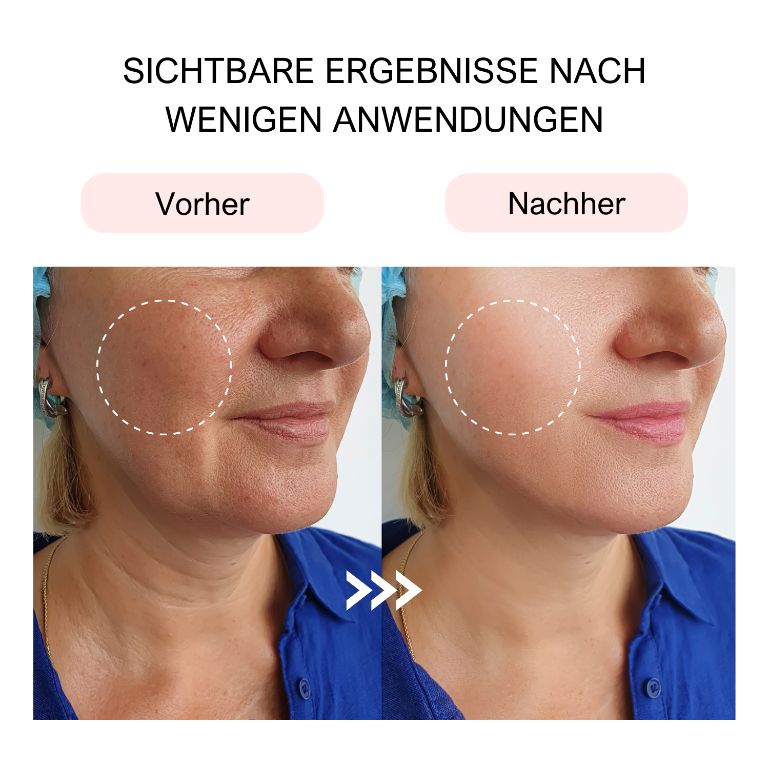 PDRN Peptide Serum
